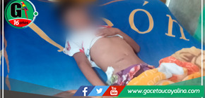 Alegaciones de negligencia médica en hospital de La Banda y Tarapoto