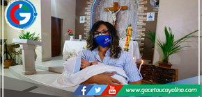 Salvan vida de bebé que nació con tumor gigante en la cabeza