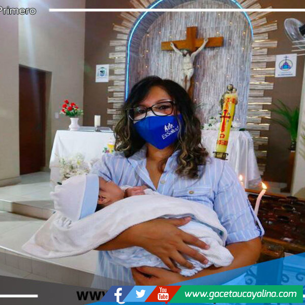 Salvan vida de bebé que nació con tumor gigante en la cabeza