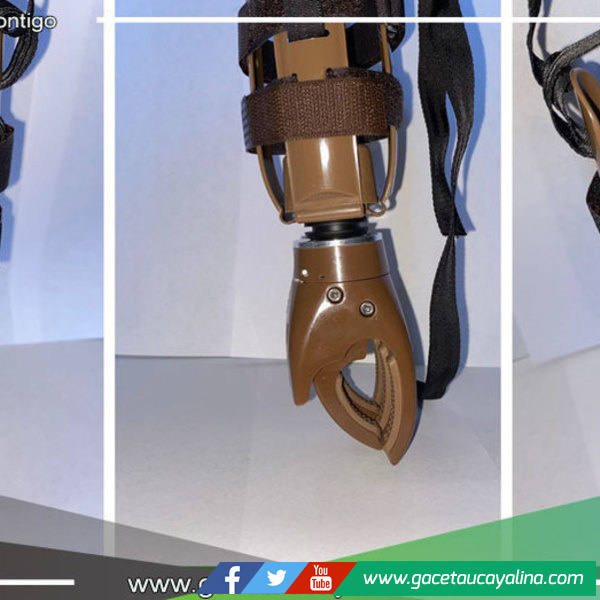 Goreu y DIRESA logran donación de 25 prótesis de manos para personas con discapacidad