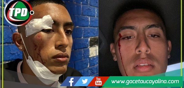 Fabrizio Roca, jugador de Sport Boys, fue agredido cerca de su casa