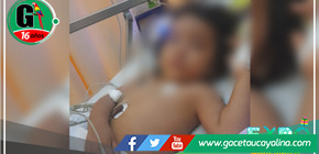 Niña resulta herida por agua caliente en accidente doméstico