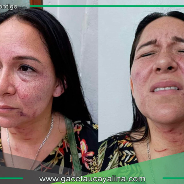 Regidora de Maynas denuncia agresión