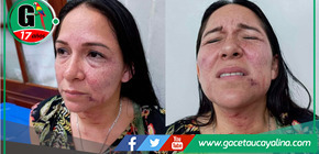 Regidora de Maynas denuncia agresión