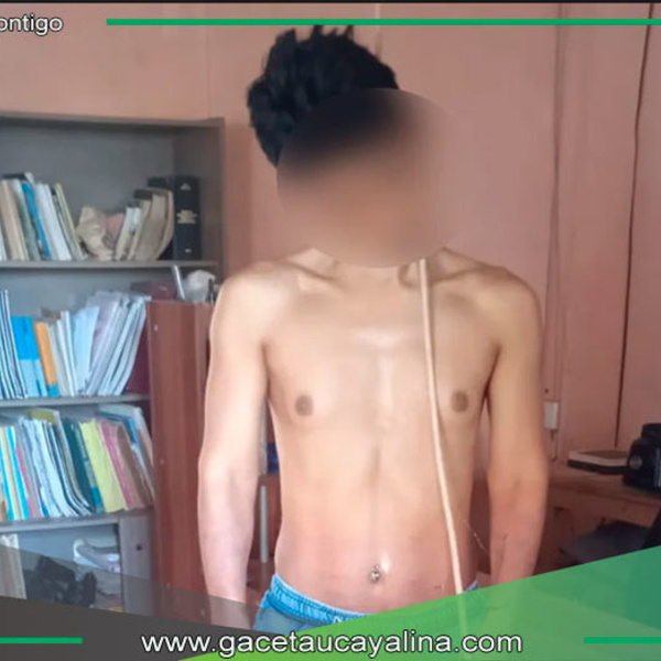 Joven se quita la vida en su vivienda. 