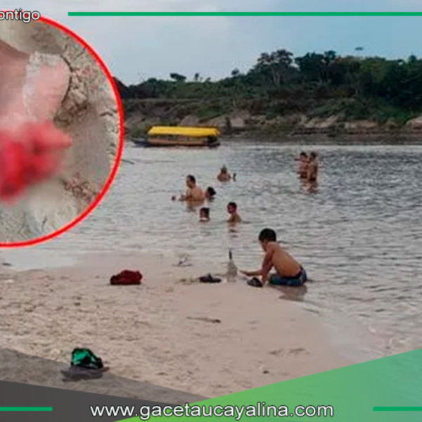 Ataque de pirañas en Iquitos deja 10 heridos