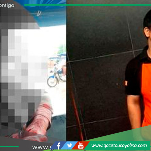 Estudiante de la UNU sufre grave accidente