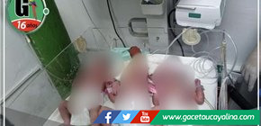 Nacen trillizos en Hospital Iquitos: Un logro médico y humano 