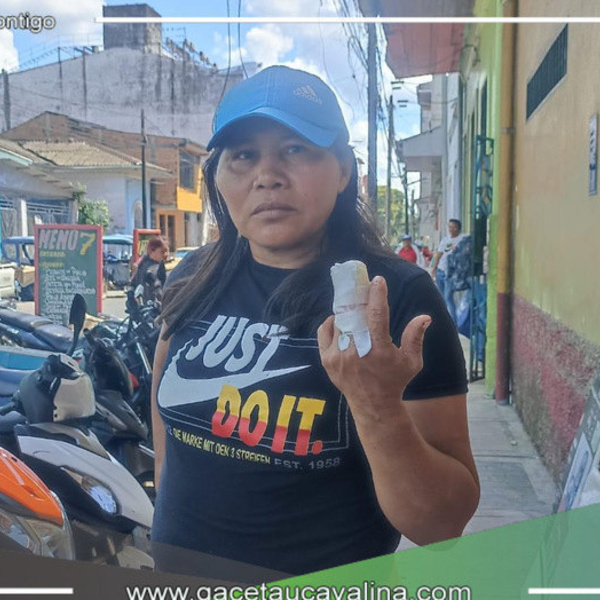 Mujer se fractura el dedo 