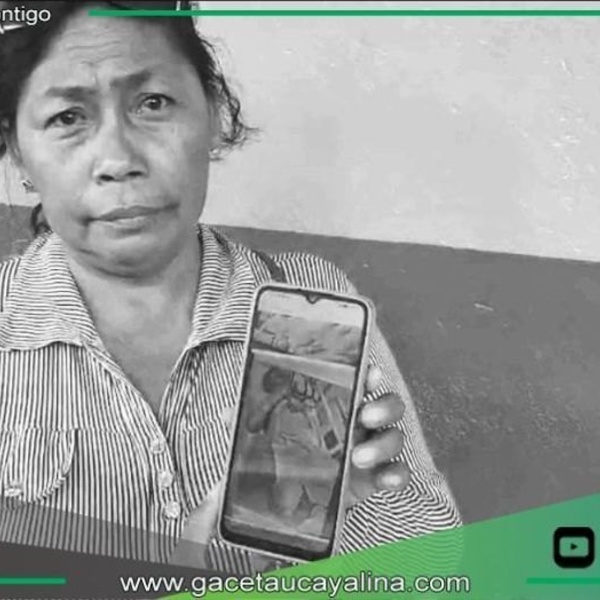 Familia denuncia amputación no autorizada y muerte de adulto mayor en Hospital de Iquitos.