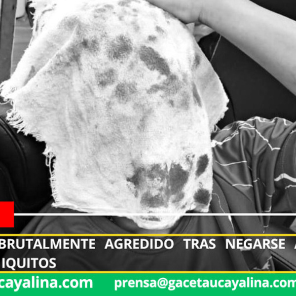 Barbero es brutalmente agredido tras negarse a pagar cupo extorsivo en Iquitos