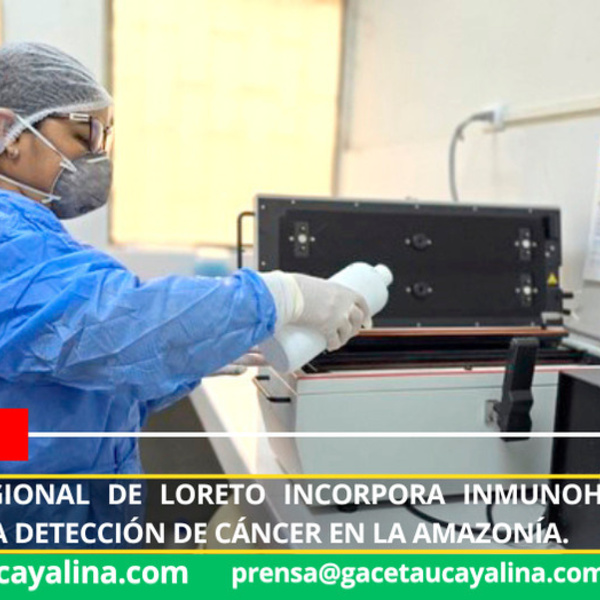 Foto: Diario La Región