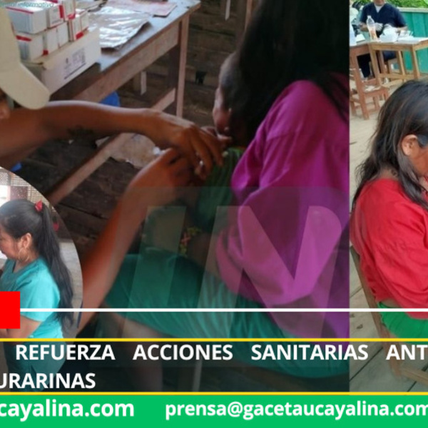 Brigadas de salud atienden brote de tosferina en zonas rurales de Loreto
