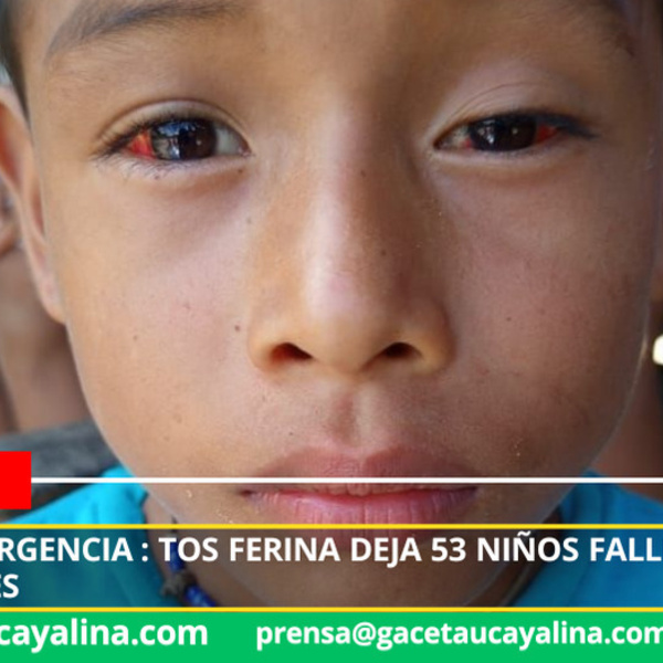 Loreto concentra la mayor tasa de muertes por tos ferina en el país