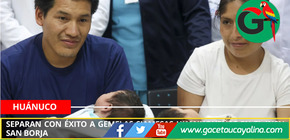 Separan con éxito a gemelas siamesas huanuqueñas en el INSN San Borja