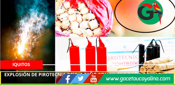 Explosión de pirotecnia deja niño con severo daño ocular.