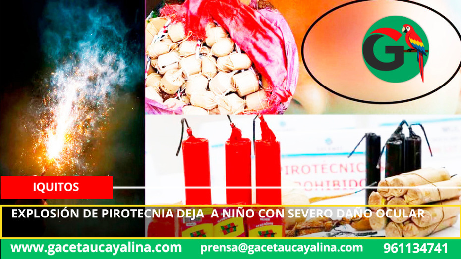 Explosión de pirotecnia deja niño con severo daño ocular.