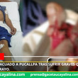 Hombre es evacuado a Pucallpa tras sufrir graves quemaduras por caída de rayo.
