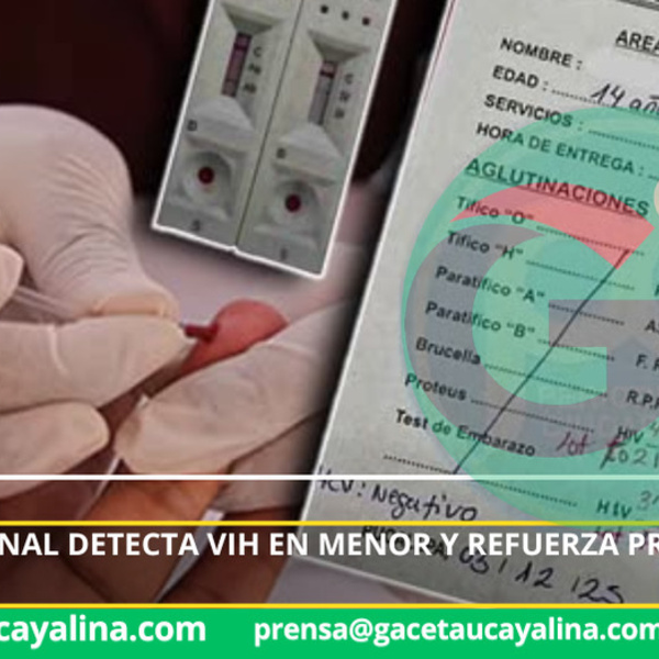 Alerta sanitaria en Pucallpa tras diagnóstico de VIH en adolescente