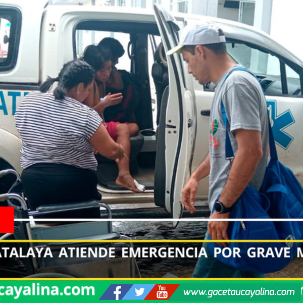 Hospital de Atalaya atiende emergencia por grave mordedura de serpiente