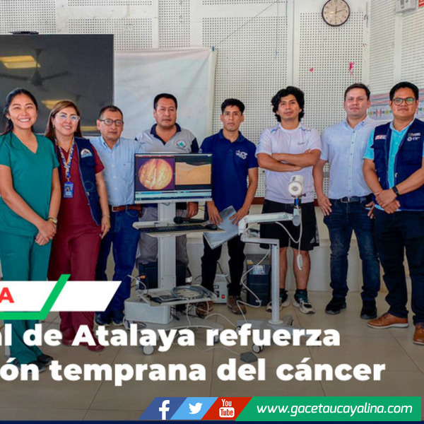 Hospital de Atalaya refuerza detección temprana del cáncer uterino