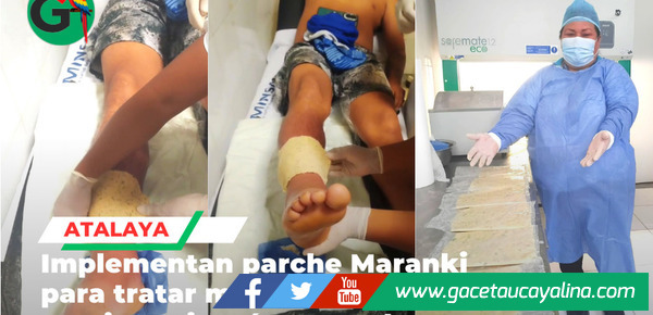 Hospital de Atalaya implementa parche ancestral contra mordedura de jergón