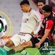 Universitario cae 2-1 frente a Melgar y complica sus aspiraciones en el Apertura 