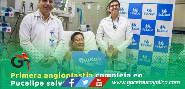 EsSalud Ucayali salva vida con histórica angioplastia de alta complejidad