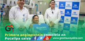 EsSalud Ucayali salva vida con histórica angioplastia de alta complejidad