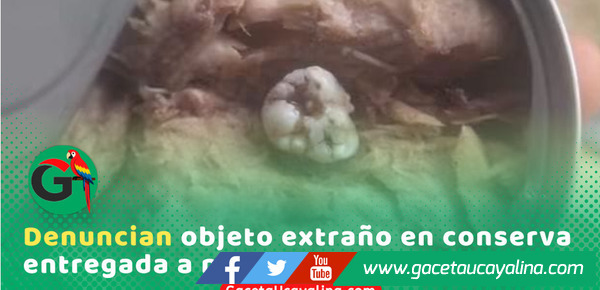 Escolares hallan presunto diente humano en conserva en Masisea