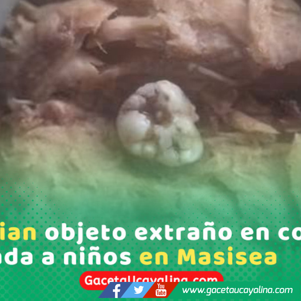 Escolares hallan presunto diente humano en conserva en Masisea