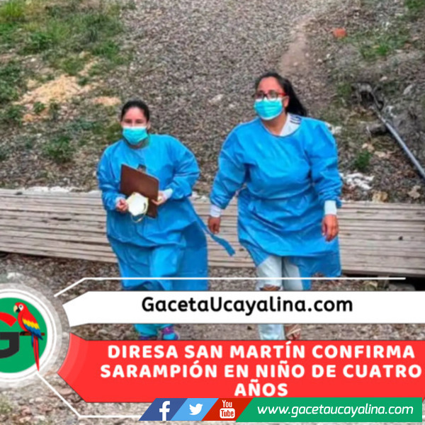San Martín confirma primer caso de sarampión y activa operativo sanitario